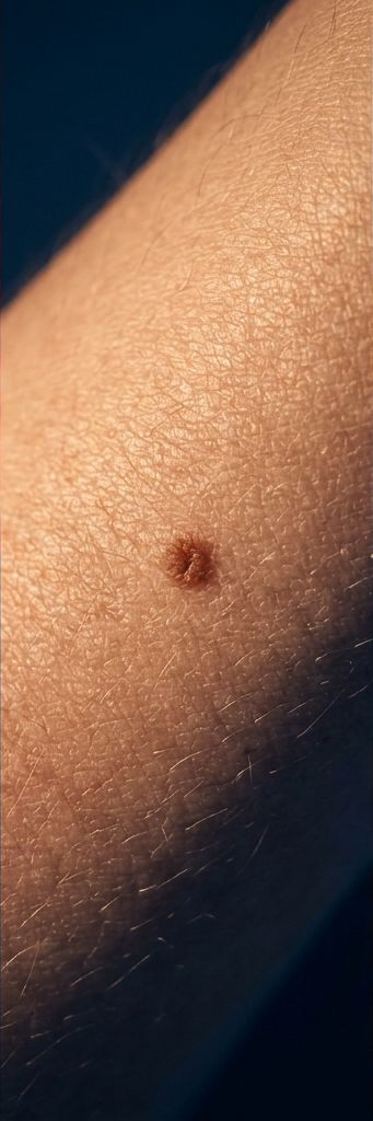 Macro of healthy skin texture with a single small mole